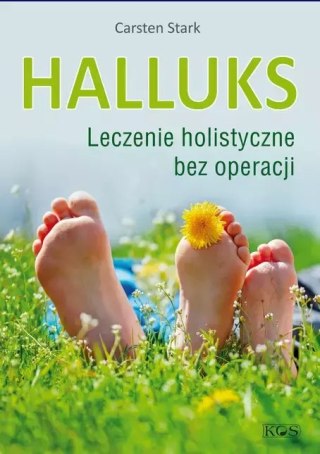 Halluks. Leczenie holistyczne bez operacji