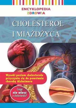 Encyklopedia zdrowia. Cholesterol i miażdżyca