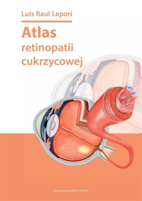 Atlas retinopatii cukrzycowej Atlas retinopatii cukrzycowej