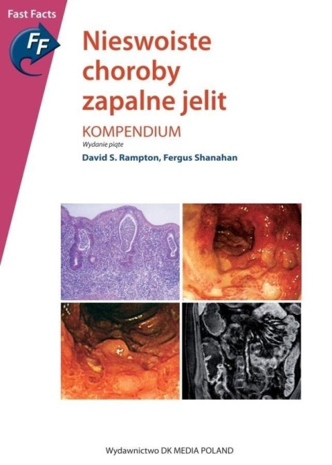 Nieswoiste choroby zapalne jelit Nieswoiste choroby zapalne jelit