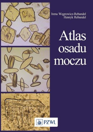 Atlas osadu moczu