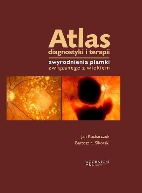 Atlas diagnostyki i terapii zwyrodnienia plamki...