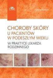 Choroby skóry u pacjentów w podeszłym wieku
