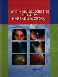 Autoimmunologiczne choroby narządu wzroku Autoimmunologiczne choroby narządu wzroku