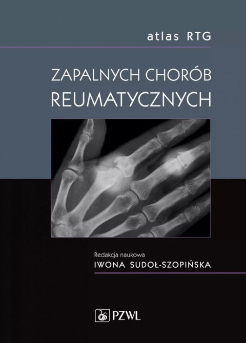 Atlas RTG zapalnych chorób reumatycznych Atlas RTG zapalnych chorób reumatycznych