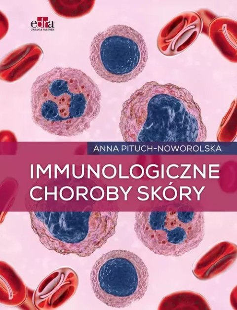 Immunologiczne choroby skóry Immunologiczne choroby skóry